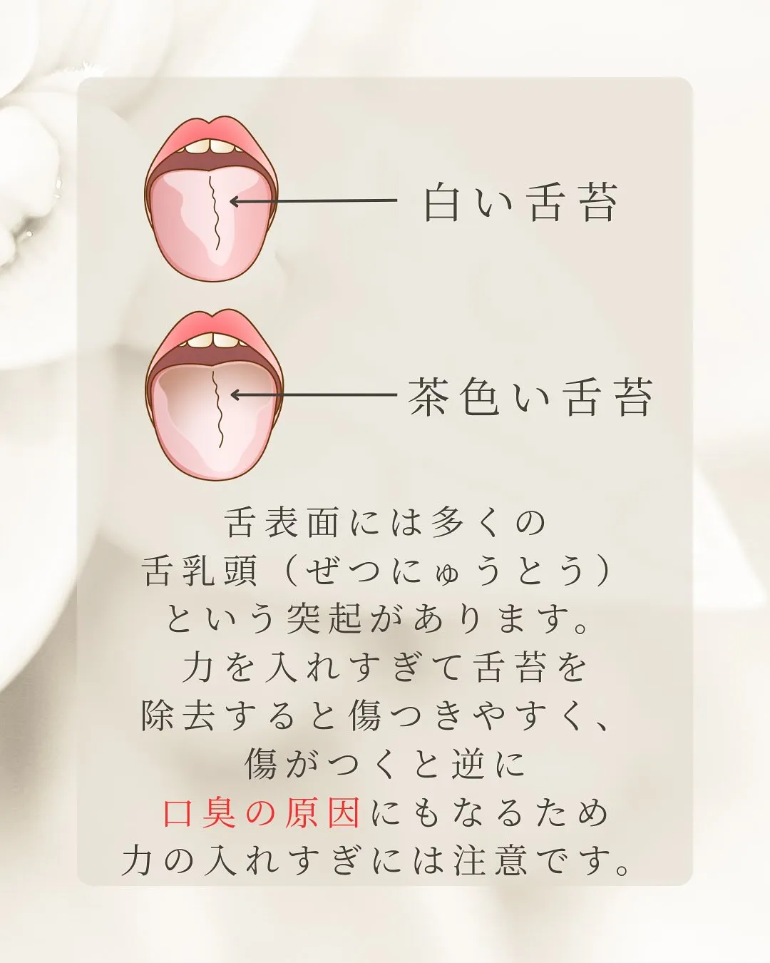 こんにちは、Nicoliスタッフの鈴木です。